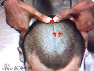 艾灸常用的保健穴有哪些？--百會(huì)