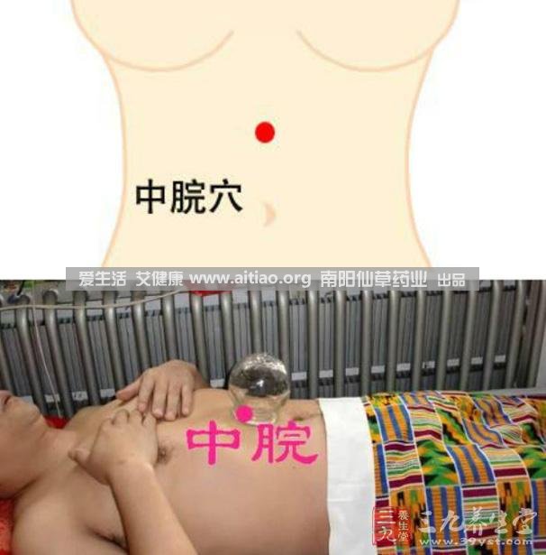 中脘穴位于腹部正中線，臍上4寸的位置上。每天艾灸10-15分鐘，能有效緩解胃部不適的癥狀，同時有助于祛濕。